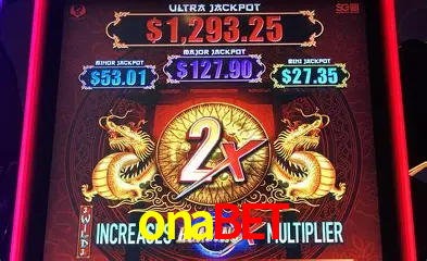 Descubra a Magia dos Jogos de Arcade no onabet
